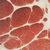 Metabolic Health